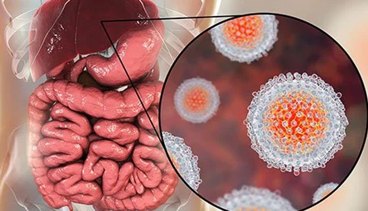 hepatitis day 2022 theme,world hepatitis day 2022 slogan,world hepatitis day activities,hepatitis b,hepatitis treatment,hepatitis symptoms,hepatitis a b c,hepatitis diagnosis,hepatitis types,how to make your liver healthy again,liver health formula,liver health detox,liver healthy foods,Health,health news,healthy living