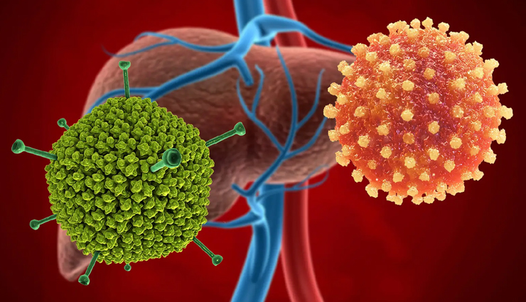 World Hepatitis Day 2023: हेपेटाइटिस के लक्षण, कारण और उपचार
