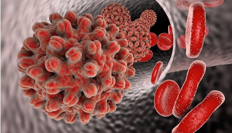 hepatitis,hepatitis b,hepatitis b diagnose,Health,Health tips