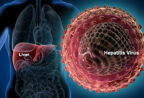 hepatitis b,cause of hepatitis b