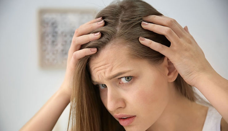 5 Herbs To Help You Deal With Hair Loss