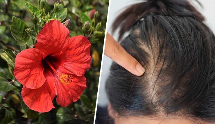 6 DIY Ways To Use Hibiscus For Hair Growth