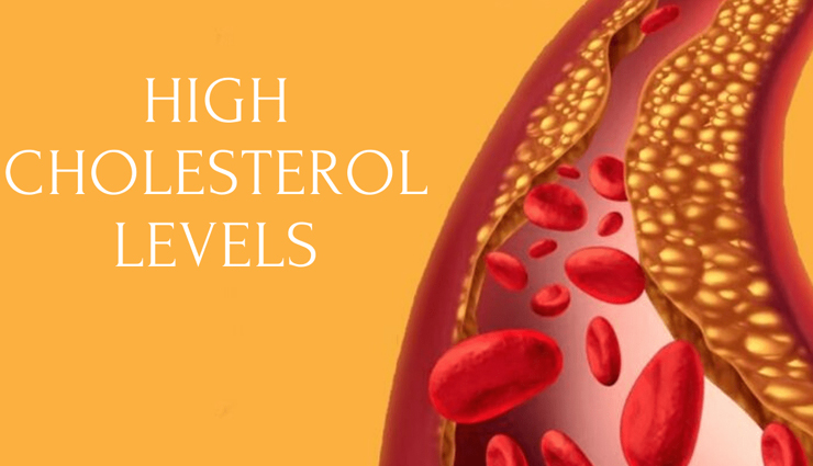 high cholesterol,symptoms of high cholesterol,Health tips,fitness tips