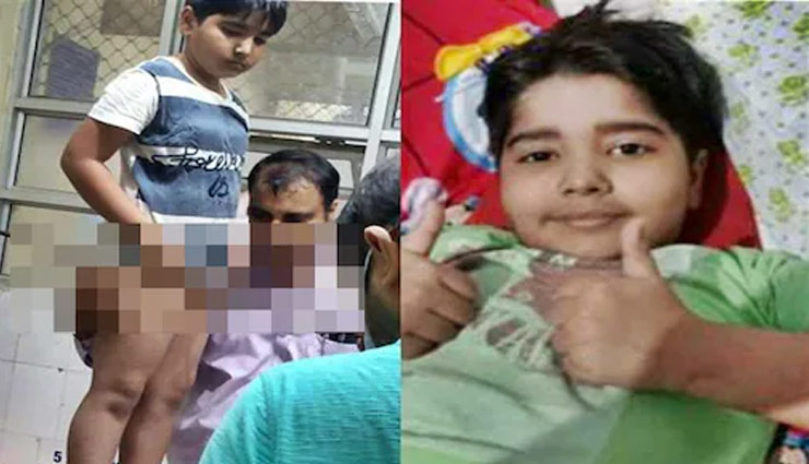 हिमाचल: बच्चे के पेट से आर-पार हुआ 4 फीट का सरिया, चंडीगढ़ PGI में हुआ सफल ऑपरेशन 
