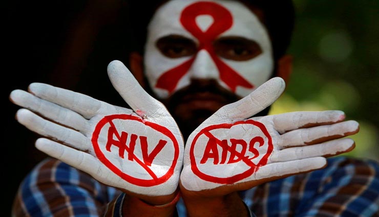 Health tips,health tips in hindi,hiv aids,hiv aids symptoms,hiv aids causes