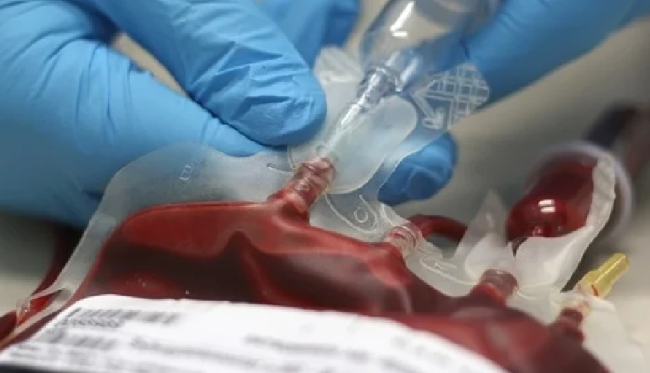 झारखंड में अस्पताल की लापरवाही, 5 बच्चों को HIV पॉजिटिव ब्लड चढ़ाने का मामला, सभी संक्रमित