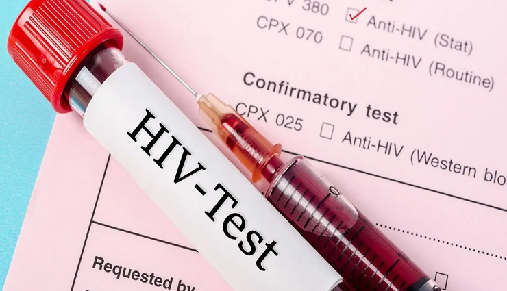 World AIDS Day: 3 स्टेज में फैलता है एड्स का वायरस, देश में हर दिन 115 लोगों की ले रहा जान, 2021 में भारत में मिले 62 हजार से ज्यादा मरीज world aids day 2022,why is world aids day important,aids day,hiv,health news,health news in hindi