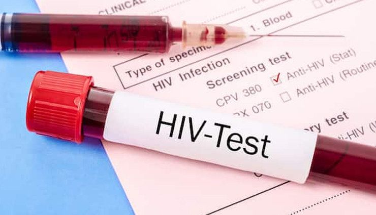 what is hiv and how to prevent it,hiv prevention methods,ways to prevent hiv infection,hiv risk reduction,hiv prevention tips,how to avoid hiv,preventing hiv transmission,safe sex hiv prevention,prep for hiv prevention,hiv testing and prevention