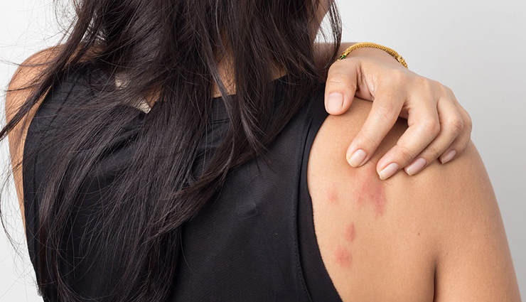 ice cubes on face disadvantages,rubbing ice cubes on face drawbacks,negative effects of using ice cubes on face,disadvantages of applying ice cubes on face,ice cube facial risks and drawbacks,problems with rubbing ice cubes on face,ice cube skincare disadvantages,potential drawbacks of using ice cubes on face,side effects of rubbing ice cubes on face,cons of applying ice cubes on face