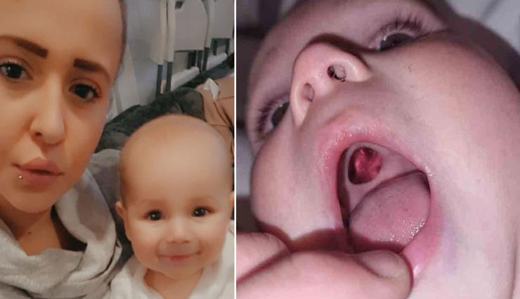 बच्चे के मुंह में छेद देखकर मां के पैरो तले खिसकी जमीन, सामने आई हैरान करने वाली सच्चाई