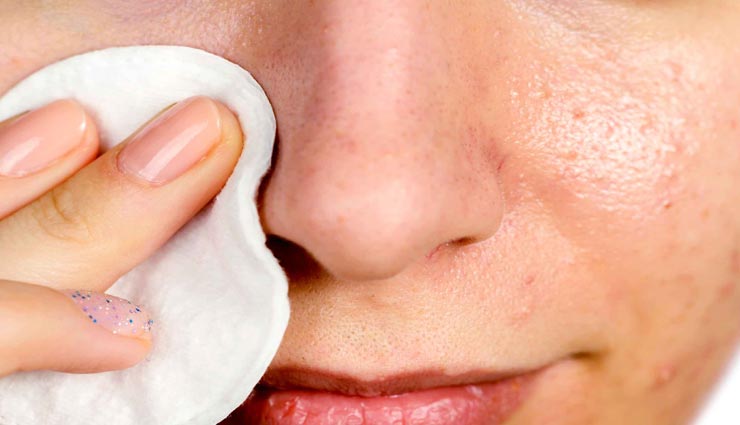 beauty tips,beauty tips in hindi,home remedies,remove holes on face,skin care tips,beautiful face