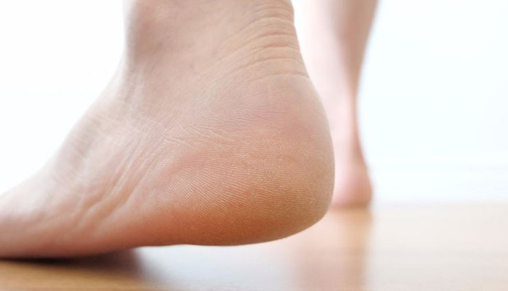 home remedies,home remedies for heel pain,heel pain,Health tips