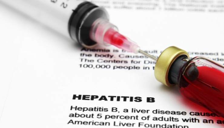 remedies for hepatitis b,home remedies,hepatitis b