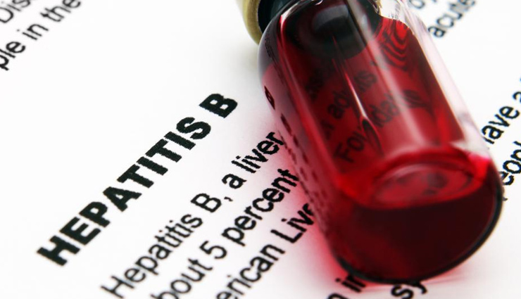 facts about hepatitis b,hepatitis b,facts