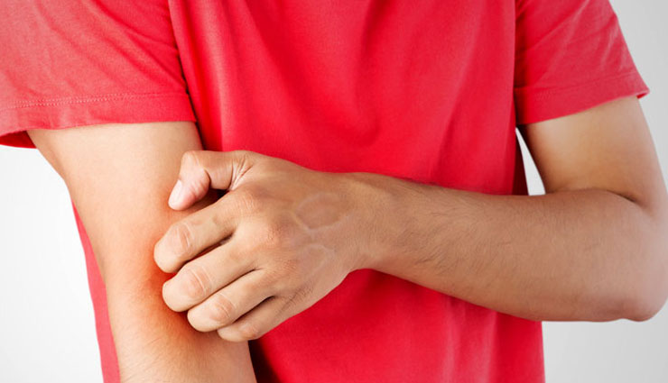 इंफेक्शन से बचने के लिए बरते सावधानी, इस तरह रहें बीमारियों से दूर