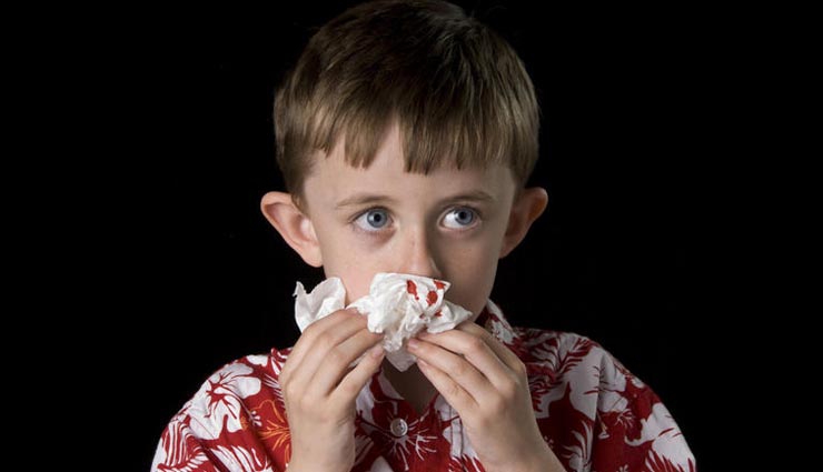 nose bleeding,nose,bleeding,Health tips,Health,healthy living ,नकसीर के घरेलु उपचार