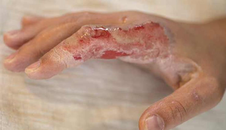 honey,health benefits of honey,Health tips,fitness tips