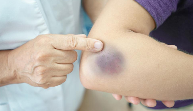 health benefits of honey,honey,Health tips,fitness tips