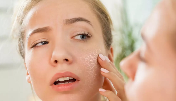 honey face mask,diy honey face mask,skin care tips,beauty tips