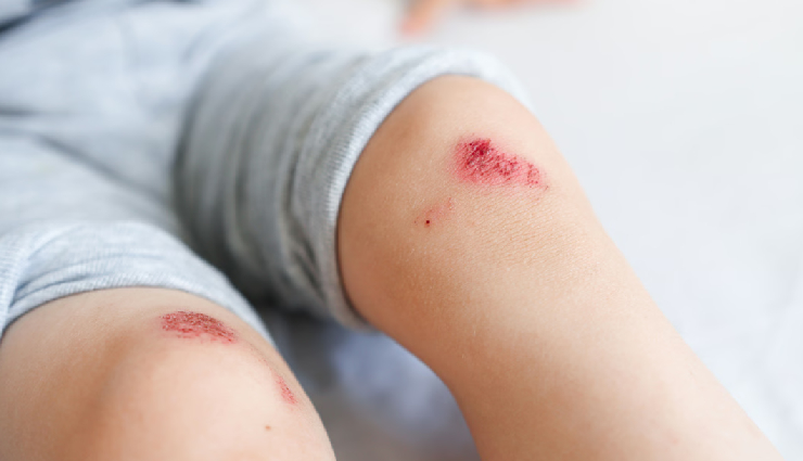 honey benefits for skin,reasons to use honey on skin,honey skincare advantages,natural skin benefits of honey,honey for healthy and glowing skin,honey for skincare routines,moisturizing effects of honey on skin,antioxidant properties of honey,clear skin with honey,healing properties of honey for skin,using honey for radiant skin,honey in beauty routines,honey for acne-prone skin,nourishing skin with honey,honey skincare tips