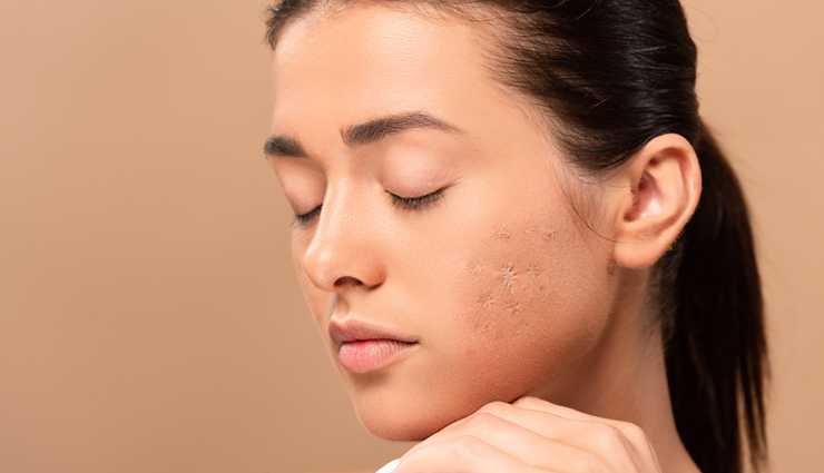 honey benefits for skin,why honey is good for skin,benefits of using honey on skin,honey for healthy skin,honey skincare benefits,natural benefits of honey for skin,honey properties for skin health,advantages of honey for skin,honey benefits for glowing skin,honey skin care benefits