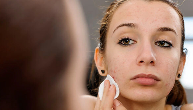 honey benefits for skin,why honey is good for skin,benefits of using honey on skin,honey for healthy skin,honey skincare benefits,natural benefits of honey for skin,honey properties for skin health,advantages of honey for skin,honey benefits for glowing skin,honey skin care benefits