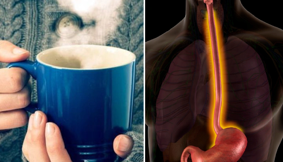 क्या आप भी उबलती हुई चाय-कॉफी तुरंत पी लेते हैं? अभी संभल जाएं, वरना ग्रासनली के कैंसर का बढ़ सकता है खतरा