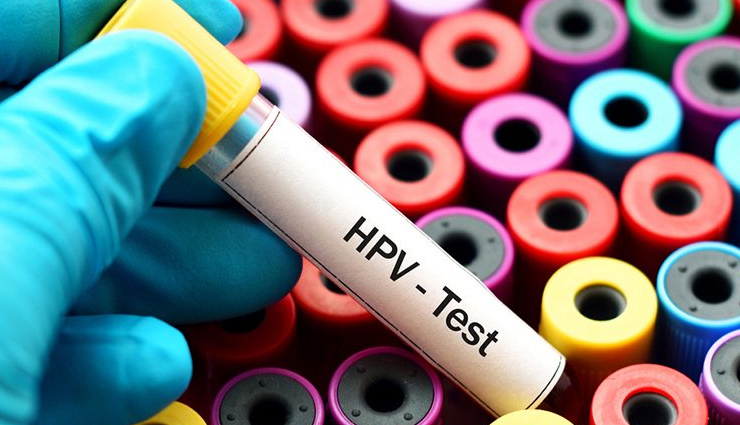 who can undergo cervical cancer screening,when should women get cervical cancer screening,cervical cancer,what is cervical cancer,Health,Health tips,health news