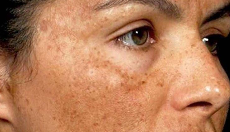 sandalwood oil benefits for skin,skincare benefits of sandalwood oil,sandalwood oil for acne treatment,anti-inflammatory properties of sandalwood oil,astringent effects of sandalwood oil,moisturizing properties of sandalwood oil,antioxidant benefits of sandalwood oil for anti-aging,sandalwood oil for even skin tone,sandalwood oil for radiant skin,calming aroma of sandalwood oil