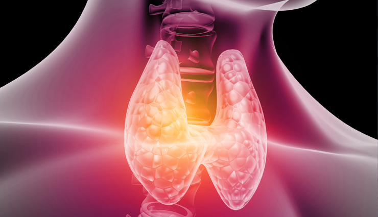 7 Natural Remedies for Hyperthyroidism