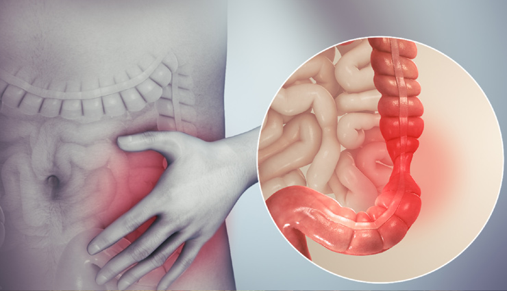 international coffee day,positive and negative effects of coffee,negative effects of coffee on the brain,international coffee day india,side effects of coffee