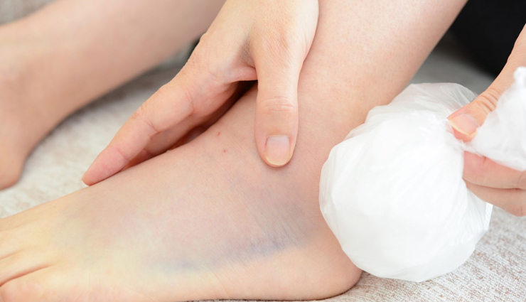 heel pain,heel pain treatment,heel pain causes,heel pain exercises,heel pain in the morning,heel pain cause,heel pain reason,heel pain home remedy,how to cure heel pain fast,home remedies for heel pain,heel pain remedies,exercise for heel pain,heel pain home remedies,heel pain treatment home remedies,heel pain treatment exercises,heel pain cure,treatment for heel pain,how to cure heel pain,Health,Health tips