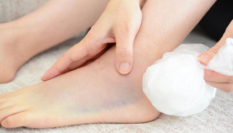 लम्बे वक्त से परेशानी बना हुआ हैं एडियों का दर्द, इन तरीकों से मिलेगा आराम Health tips,health tips in hindi,heel pain,home remedies,heel pain remedies