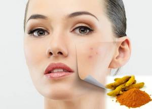 Turmeric Formula The Best way to fight Acne