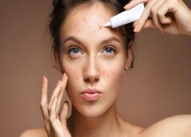 7 Remedies To Get Rid of Acne Quickly