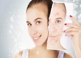 DIY Face Wash To Get Acne Free Skin