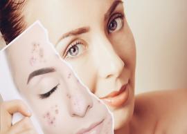 Get Acne free Skin With this DIY Hibiscus Tea and Rose Face Cream