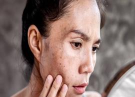11 Effective Natural Remedies To Treat Age Spots