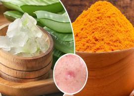 5 DIY Aloe Vera and Turmeric Recipes for Acne, Dark Spots and Pimples
