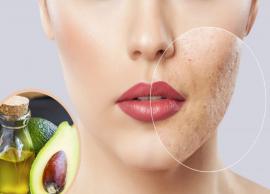 6 Ways To Use Avocado Oil for Acne Treatment