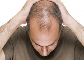 5 Home Remedies To Get Rid of Baldness