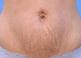 3 DIY Ways To Tighten Loose Belly Skin After Pregnancy