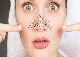 5 Home Remedies To Get Rid of Blackheads Naturally
