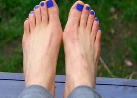 5 Remedies To Dissolve Bunions Naturally at Home