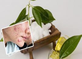 5 DIY Ways To Use Camphor Oil For Acne