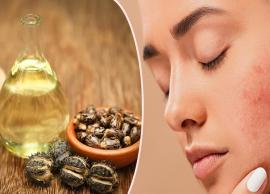 4 DIY Ways To Use Castor Oil To Treat Acne