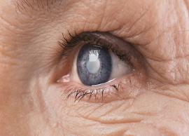 5 Wonderful Home Remedies for Cataracts