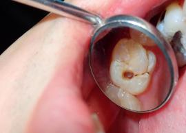 15 Ways To Get Rid of Cavities Naturally
