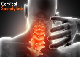 11 Remedies That are Useful for Cervical Spondylosis