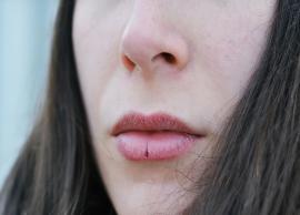 5 Natural Tips To Treat Chapped Lips